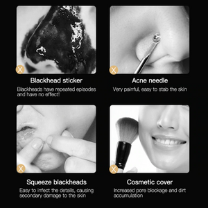 【Buy One Get Three Free】Blackhead Pore Cleaner